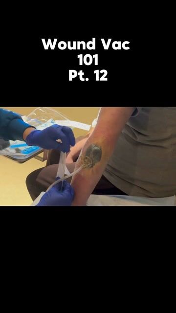 thumbnail VAC 101 with Jackie: Final Touches & Patient Comfort