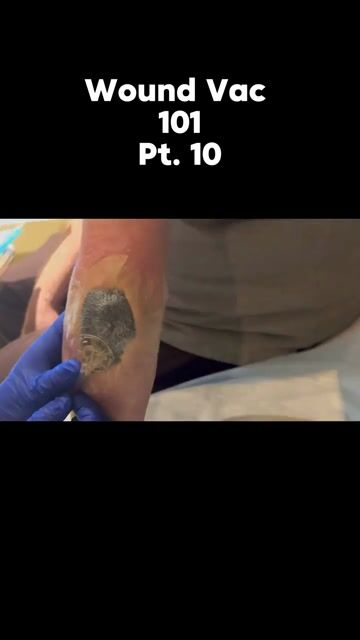 thumbnail Finding the Leak: Thumb Test 101