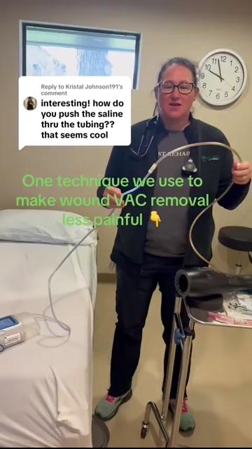 thumbnail Wound Vac Removal Saline Technique