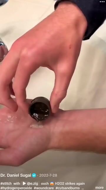 thumbnail Hydrogen Peroxide Deserves More Credit