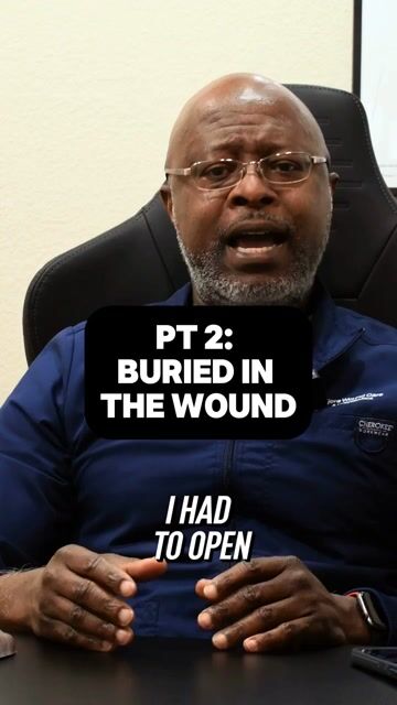 thumbnail What Happens When You Don’t Clean a Wound Properly Pt. 2